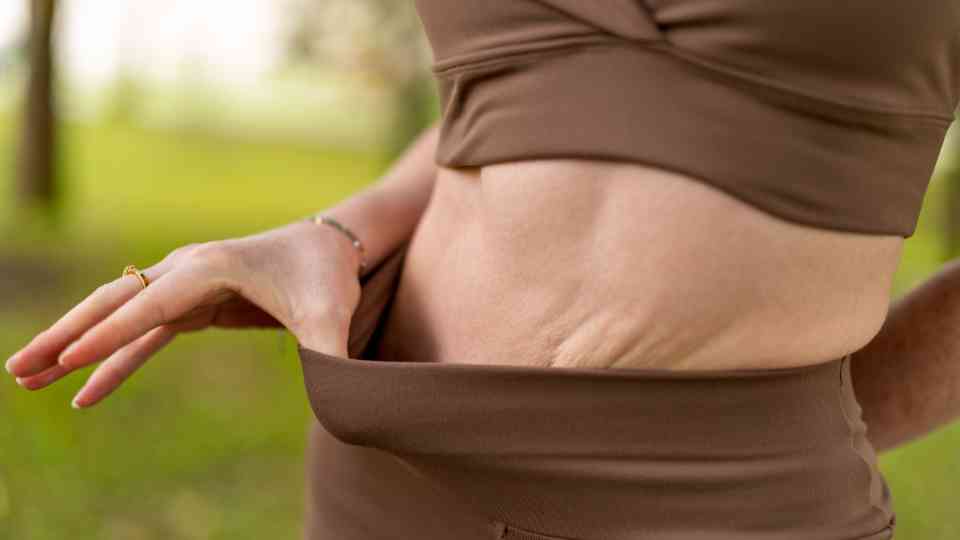 How to Avoid Loose Skin When Losing Weight: Professional Weight Loss Tips